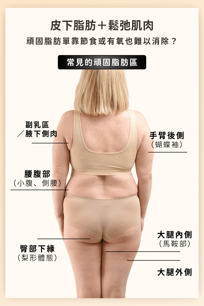 常見頑固脂肪區