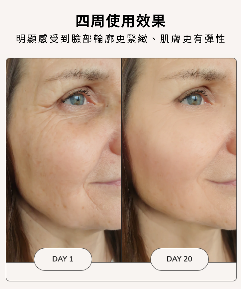 四周使用效果，明顯感受到臉部輪廓更緊緻、肌膚更有彈性